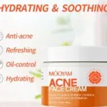 Acne Face Cream